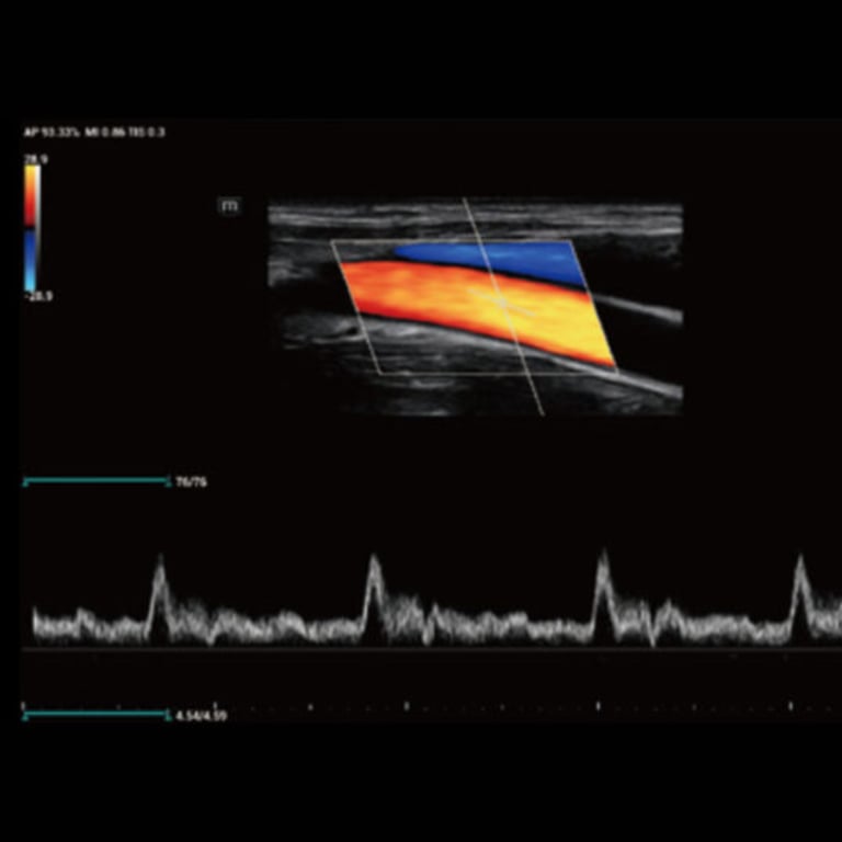 Mindray Z60 im klinischen Einsatz