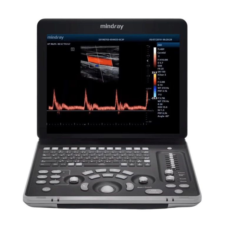 Mindray Z60 portables Ultraschallsystem 15-Zoll 8,2 kg