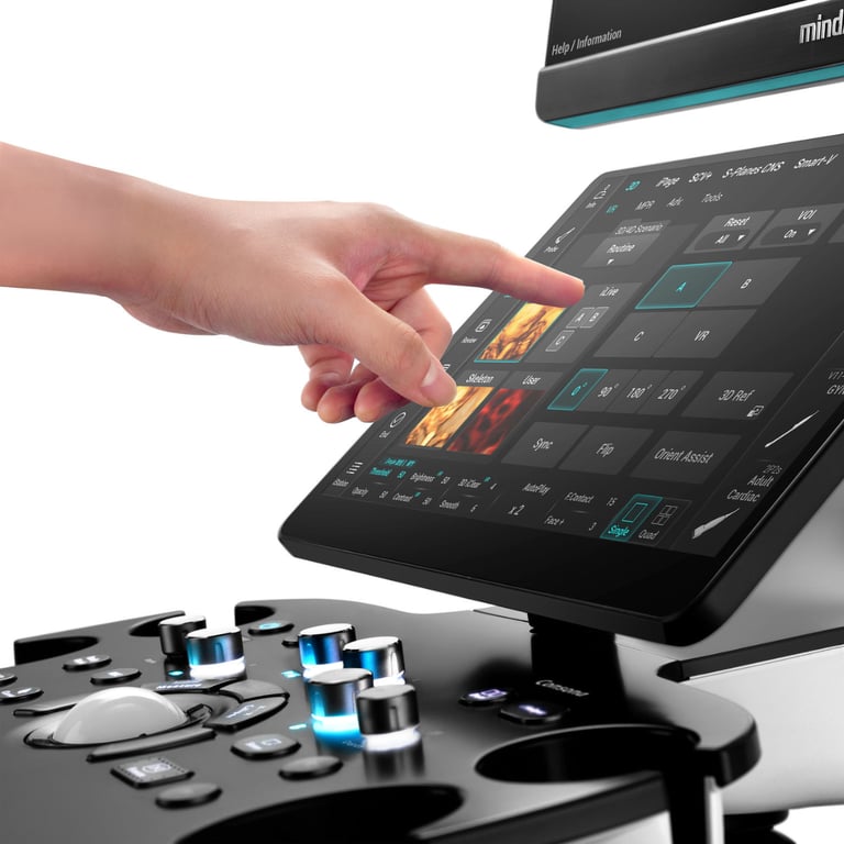 Mindray Consona N6 Bildbeispiel ZST+