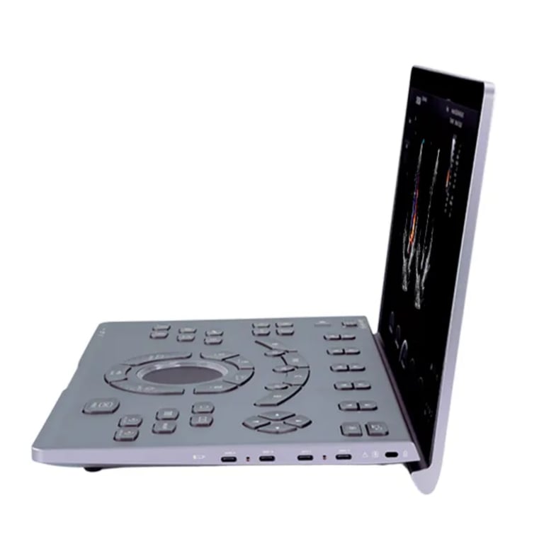 Chison SonoAir 70 mit Gerätewagen TR3000