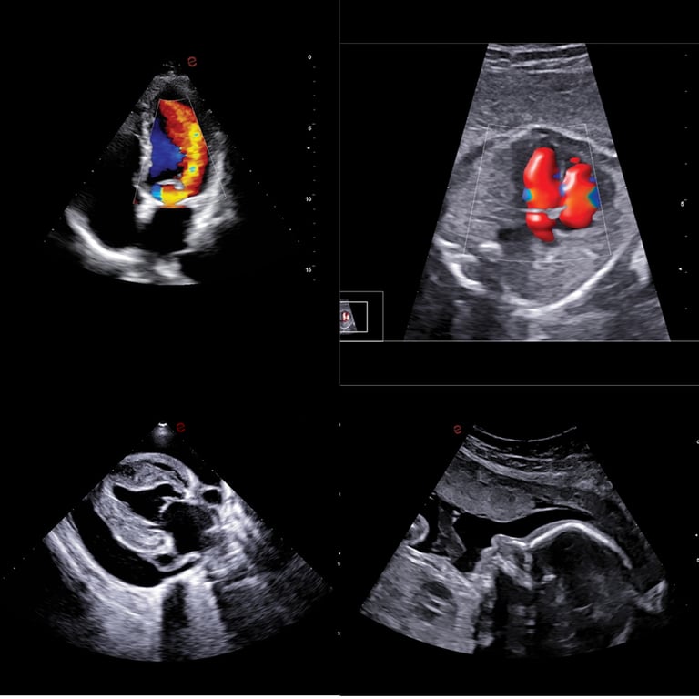 Esaote MyLab A70 Gesamtansicht mit Barco-Monitor