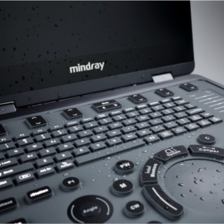 Mindray MX5 Seitenansicht mit Schallkopfports und Fingerswipe-Bedienung