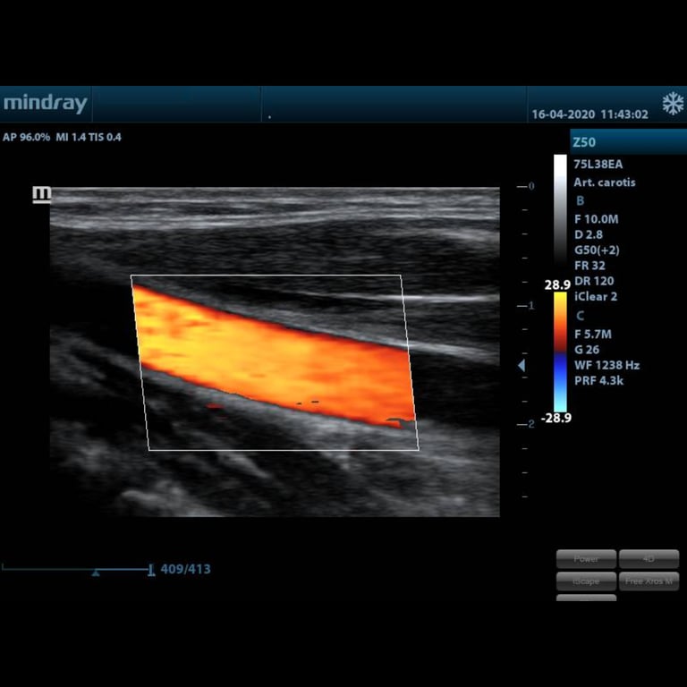 Mindray Z50 portabler Einsatz Primary Care