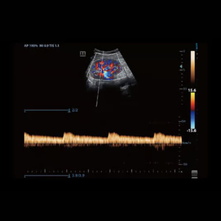 Mindray Z60 portables Ultraschallsystem 15-Zoll LCD 60-Grad Neigung