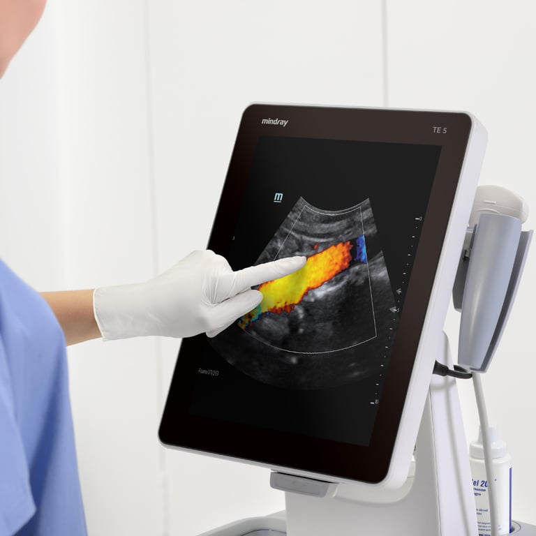 Mindray TE5 Touchscreen Ultraschallsystem Gesamtansicht auf Rollwagen