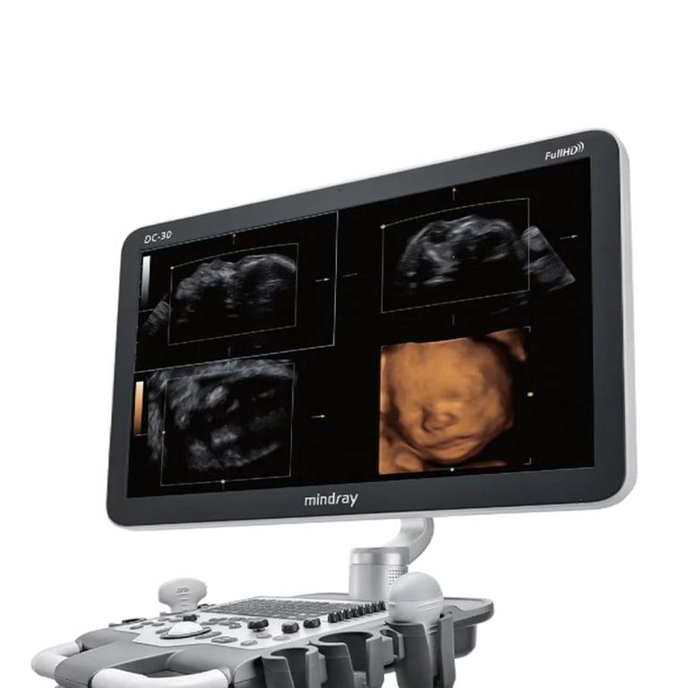 Mindray DC 30 Seitenansicht mit höhenverstellbarem Bedientableau