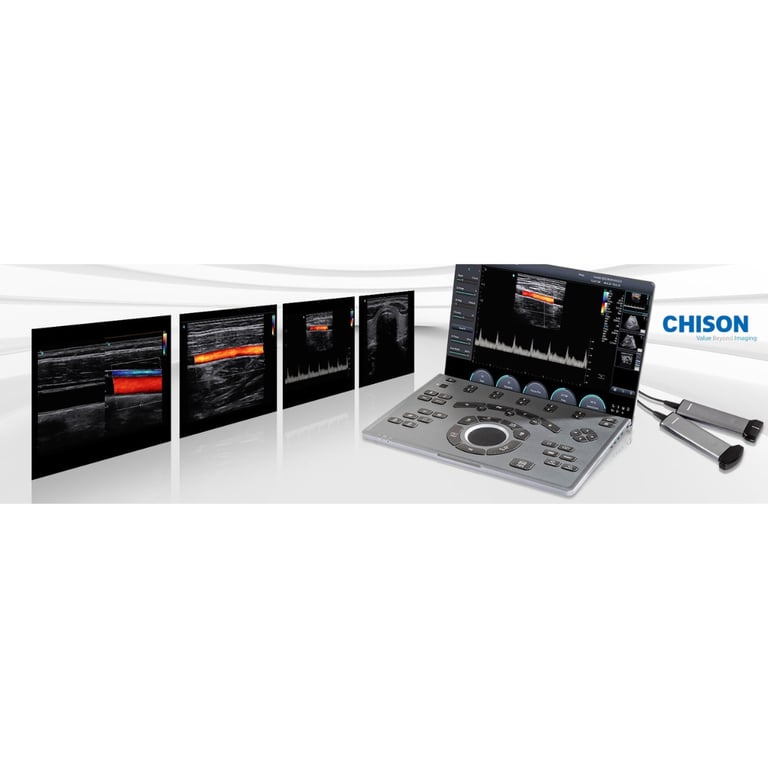 Chison SonoAir 70 klinisches Ultraschallbild