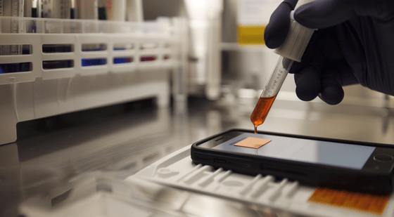 Nouveau dispositif basé sur le papier pour tester le glucose sur place à l'aide d'un smartphone