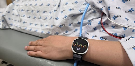Samsung lo smartwatch sarà in grado di prevedere svenimenti minuti prima che accadano The Jerusalem Post