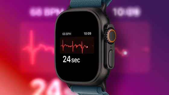 Questo è il motivo per cui il tuo smartwatch ti provoca ansia e cosa puoi fare al riguardo - CNET
