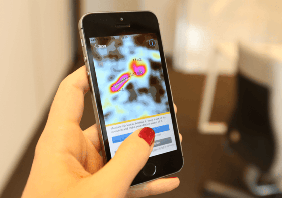 L'Istituto Internazionale di Tecnologia dell'Informazione di Hyderabad sviluppa una rivoluzionaria tecnologia AI per smartphone per il rilevamento precoce del cancro orale