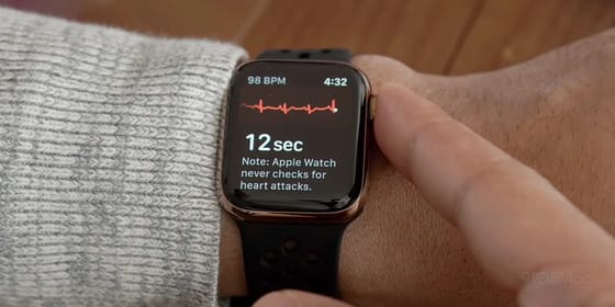 Seguimiento con ECG en reloj inteligente dirigido por el paciente tras ablación de fibrilación auricular - Colegio Americano de Cardiología