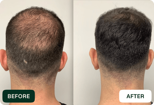Joshua B. testimonial