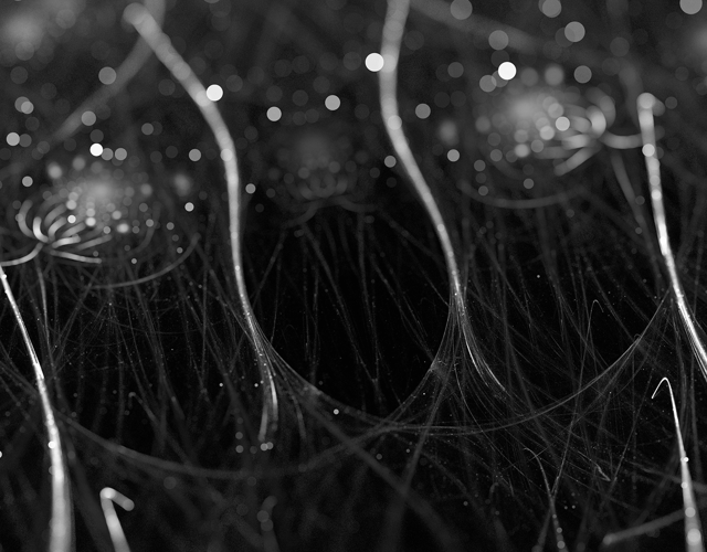 Intrinsic factors - hair follicle close up