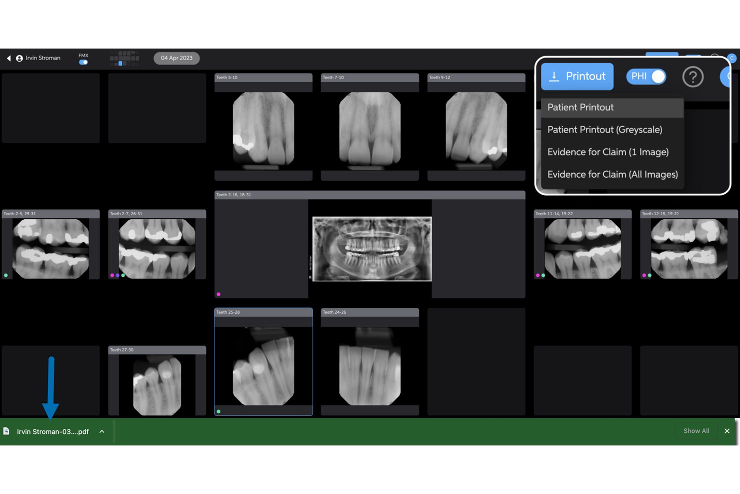 Pearl screenshot - Meilleurs logiciels dentaires IA en 2026