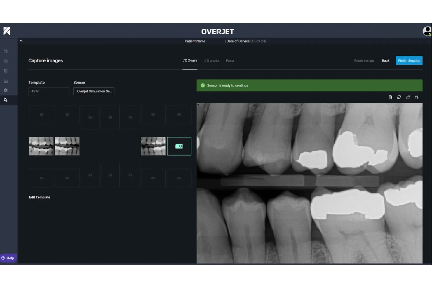 Overjet screenshot - Meilleurs logiciels dentaires IA en 2026