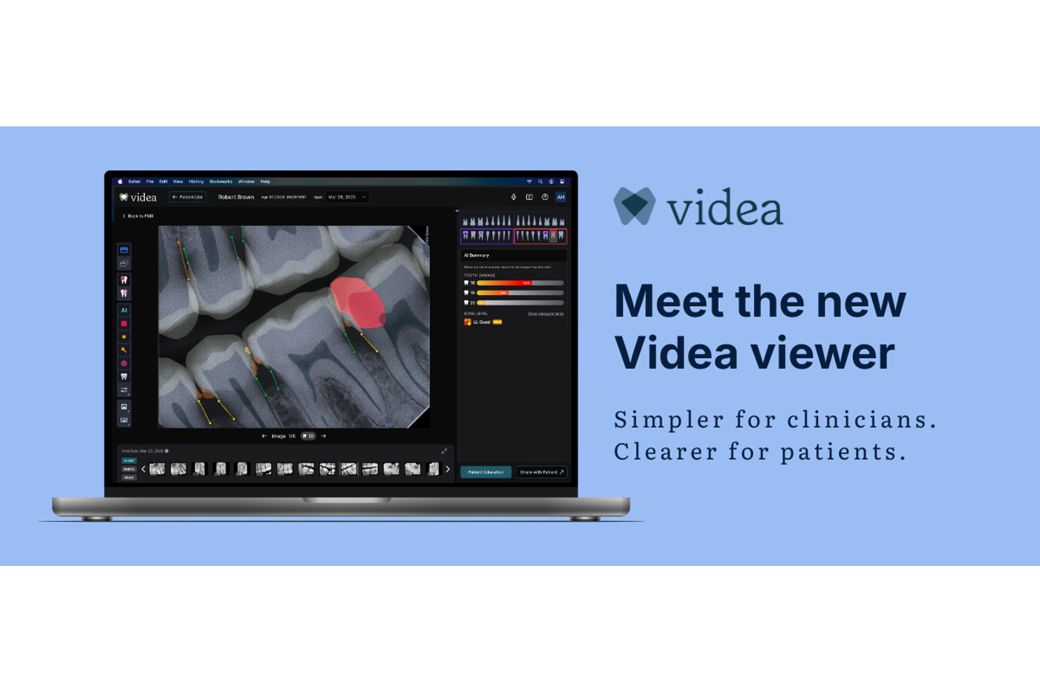 Videa (VideaHealth) screenshot - Meilleurs logiciels dentaires IA en 2026