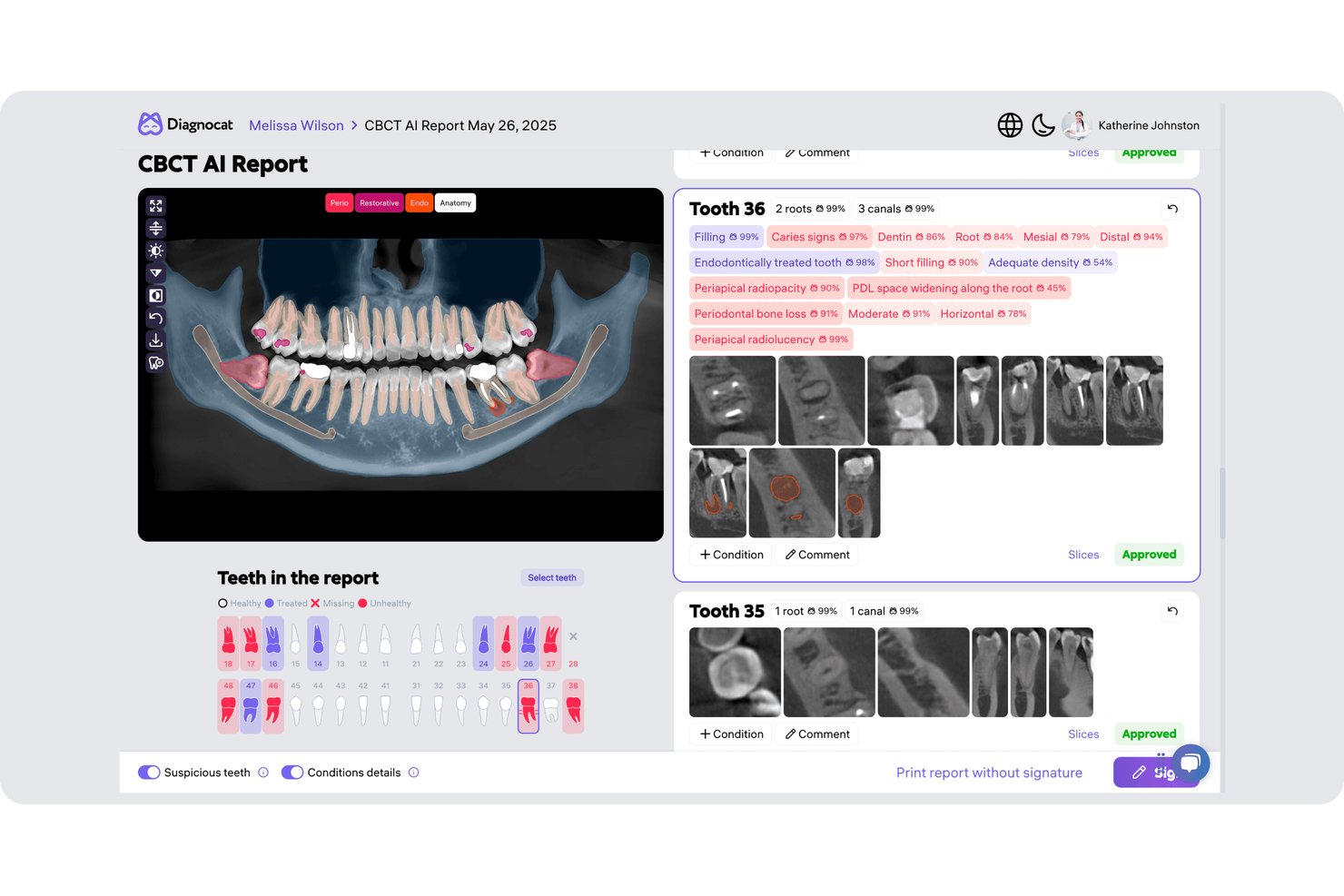 Diagnocat screenshot - Meilleurs logiciels dentaires IA en 2026