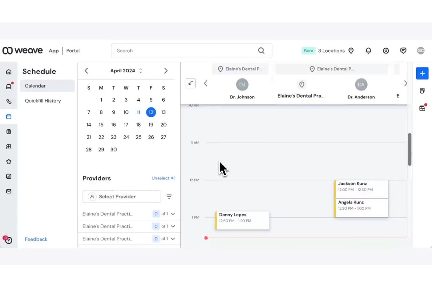 Weave screenshot - Meilleurs logiciels dentaires IA en 2026