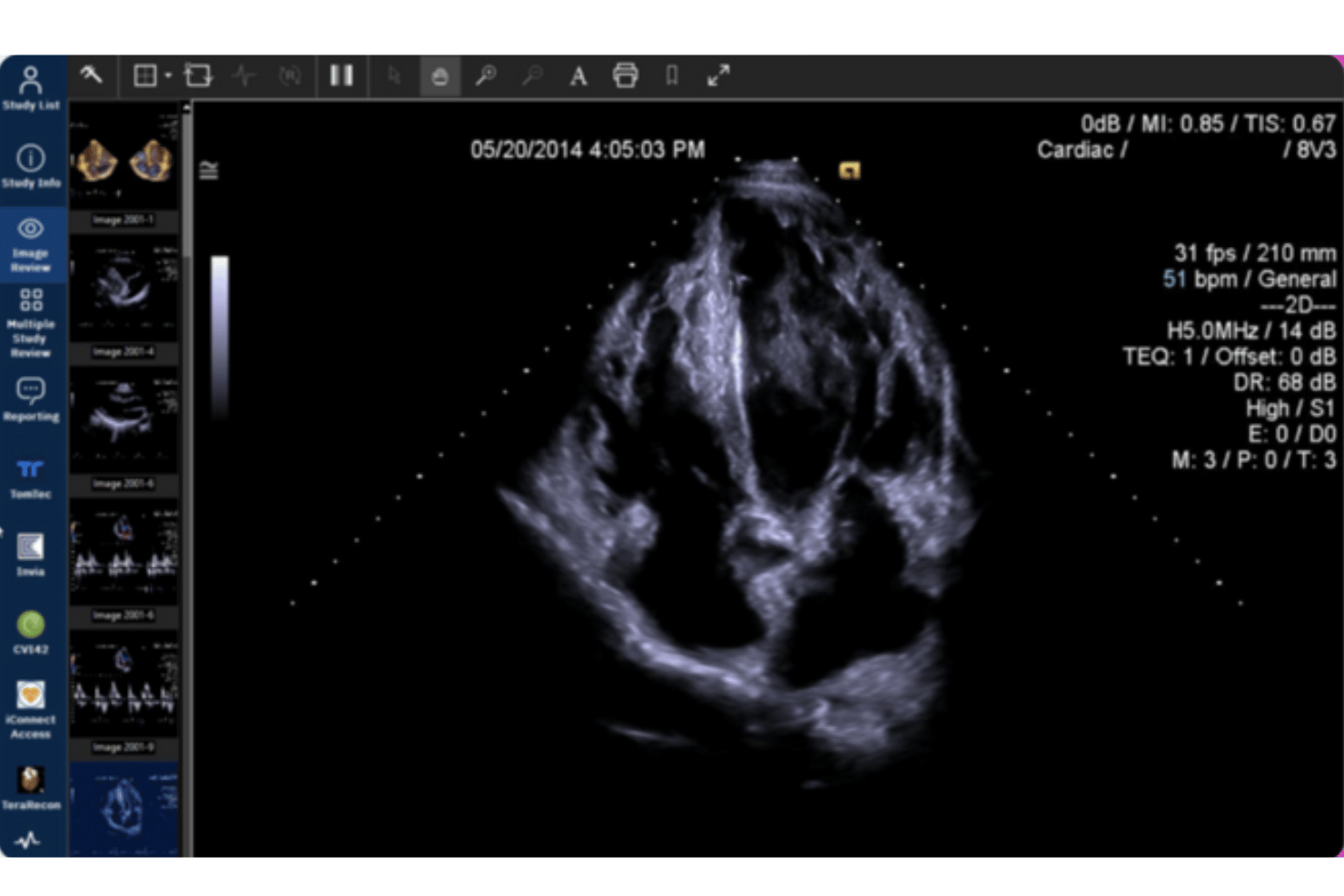 Merative Merge Cardio screenshot - 10 beste factureringssoftware voor cardiologie in 2026