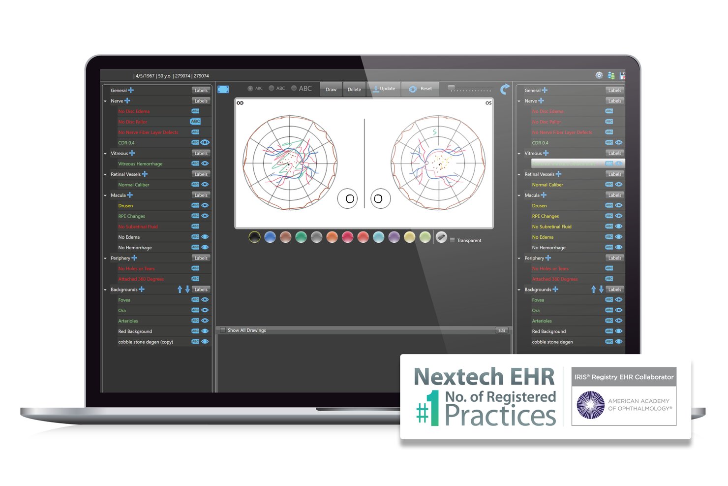 Nextech screenshot - 10 Best Vision Medical Billing Software in 2026