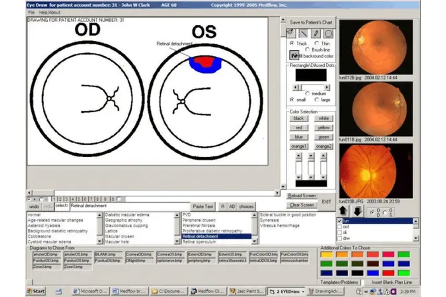 Medflow screenshot - 10 beste software voor medische facturering in de oogzorg in 2026