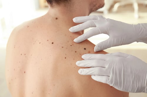 Skin Checks service image