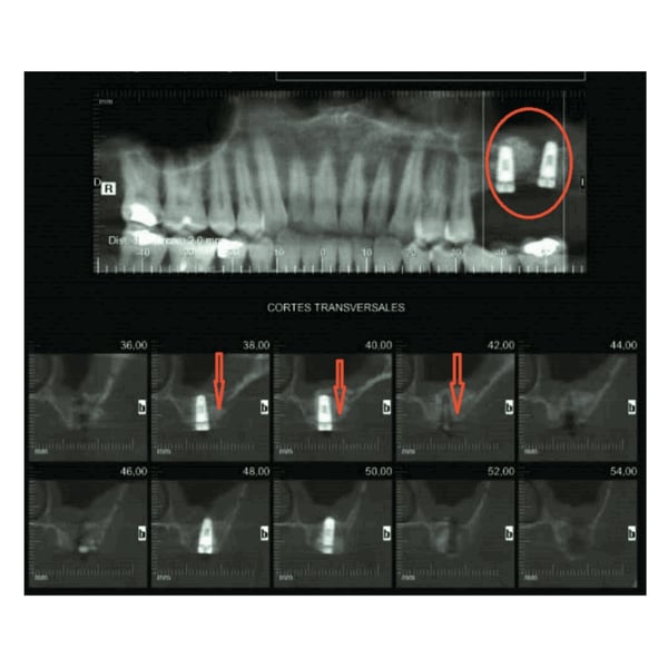 clinical case 2