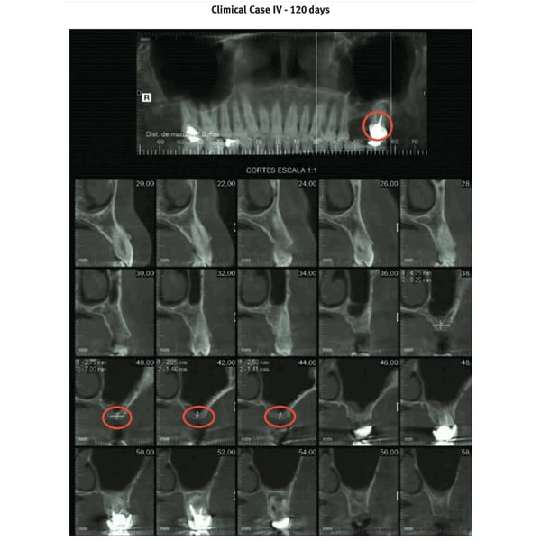 clinical case