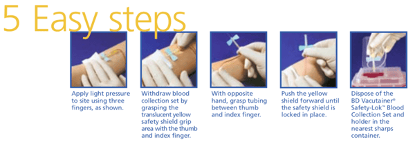 BD Vacutainer Safety-Lok Blood Collection Set: 5 Easy Steps