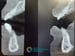 DALI One Graft Case thumbnail