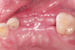 grafted site thumbnail