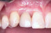 Tissue Contour 4 thumbnail