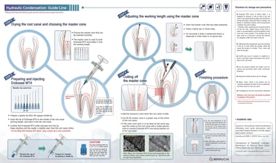 endoseal steps