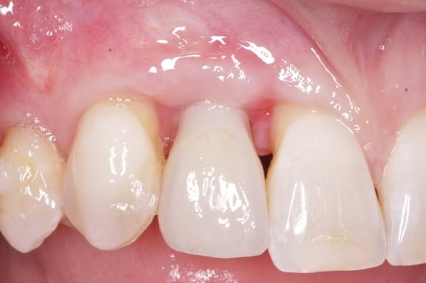 Tissue Contour 2