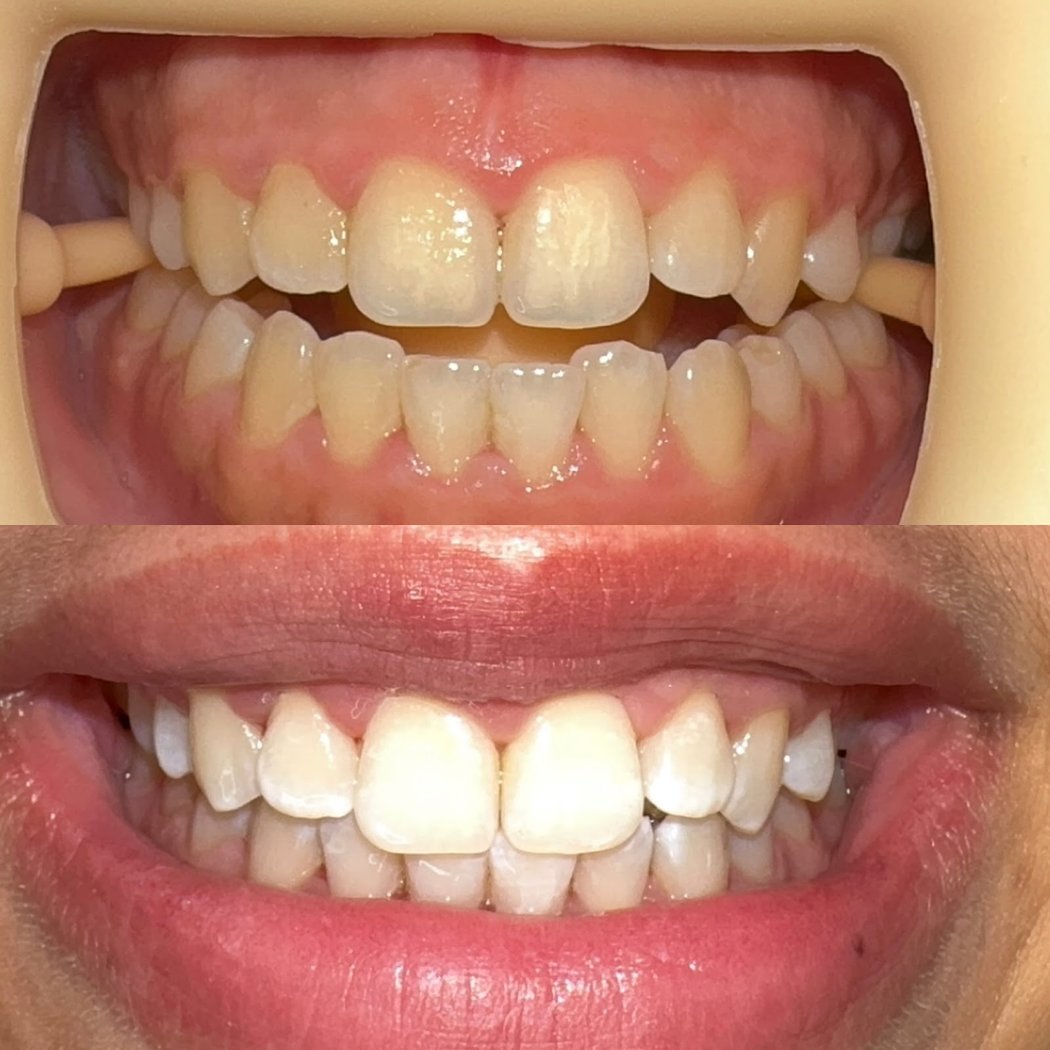 Perfect skin and smile 3