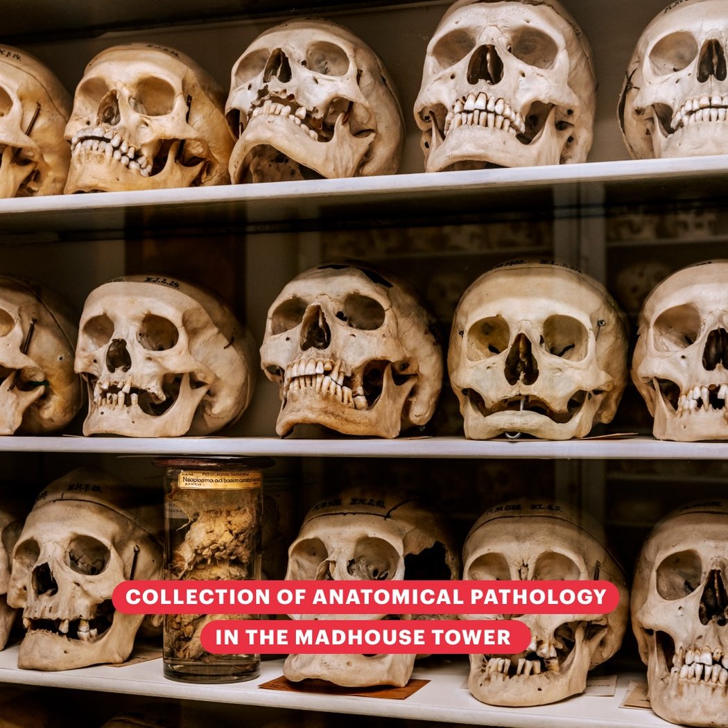 Pathological-anatomical collection in the Narrenturm 1