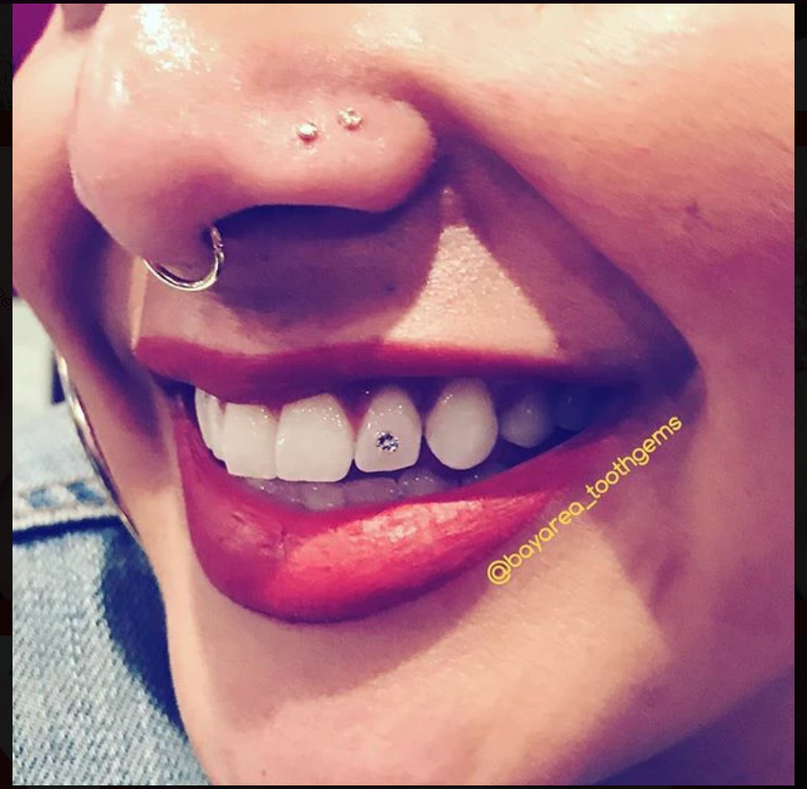 Bay Area Tooth Gems 3