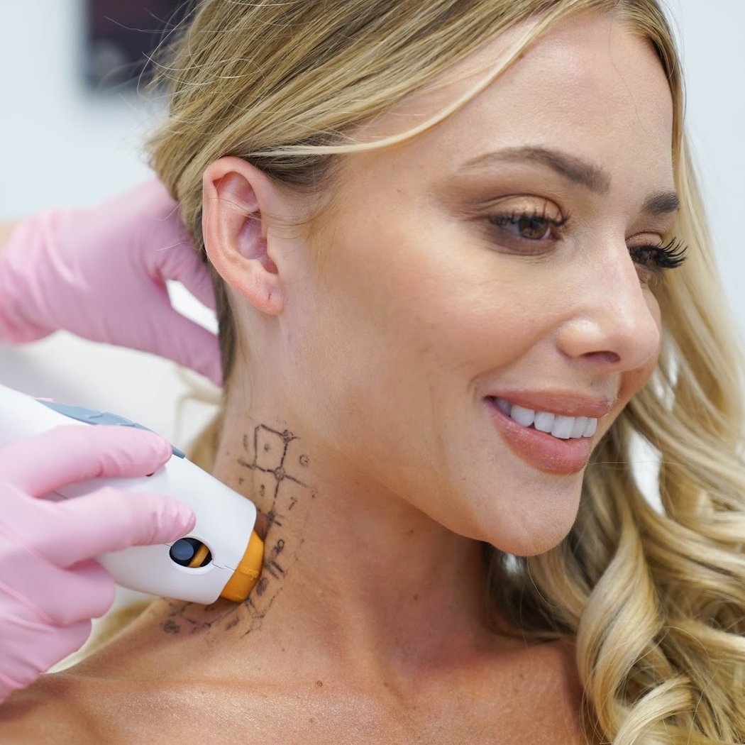 LaserAway Oakland 1