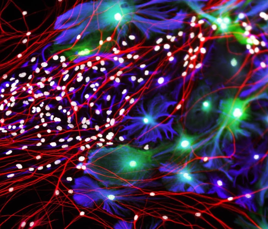 Le cerveau en pilote automatique 1