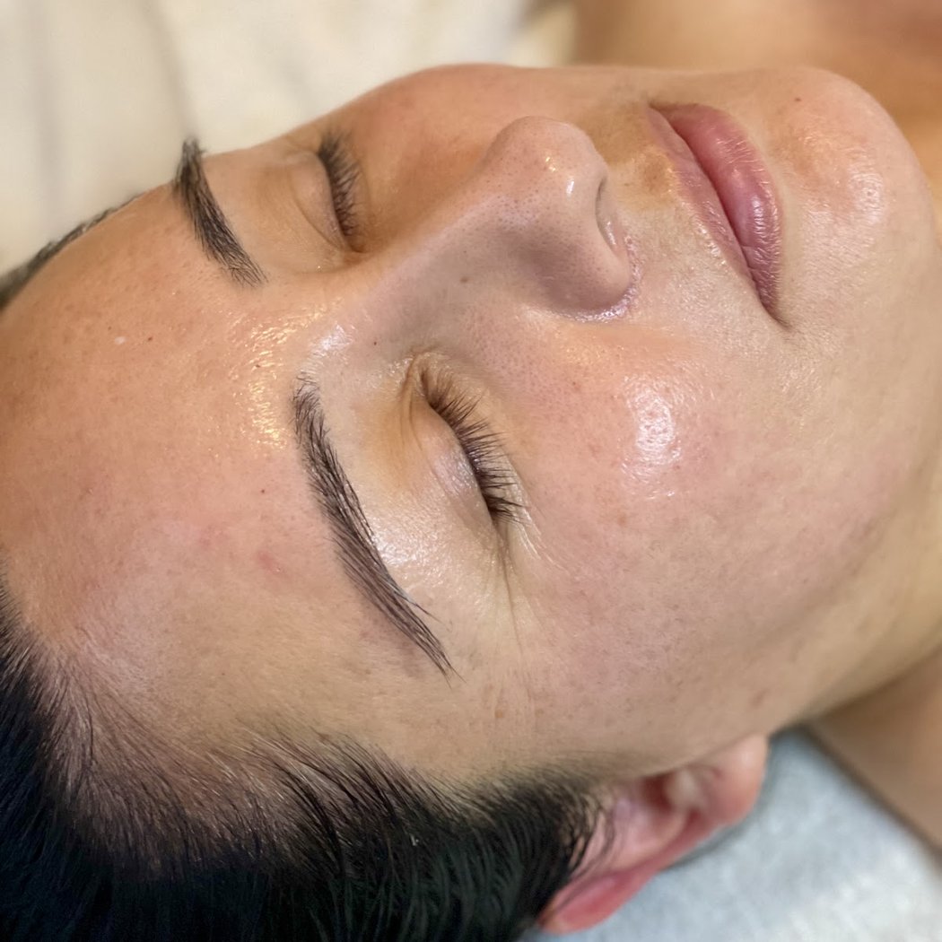 Balanced Skin and Acne Clinic 1
