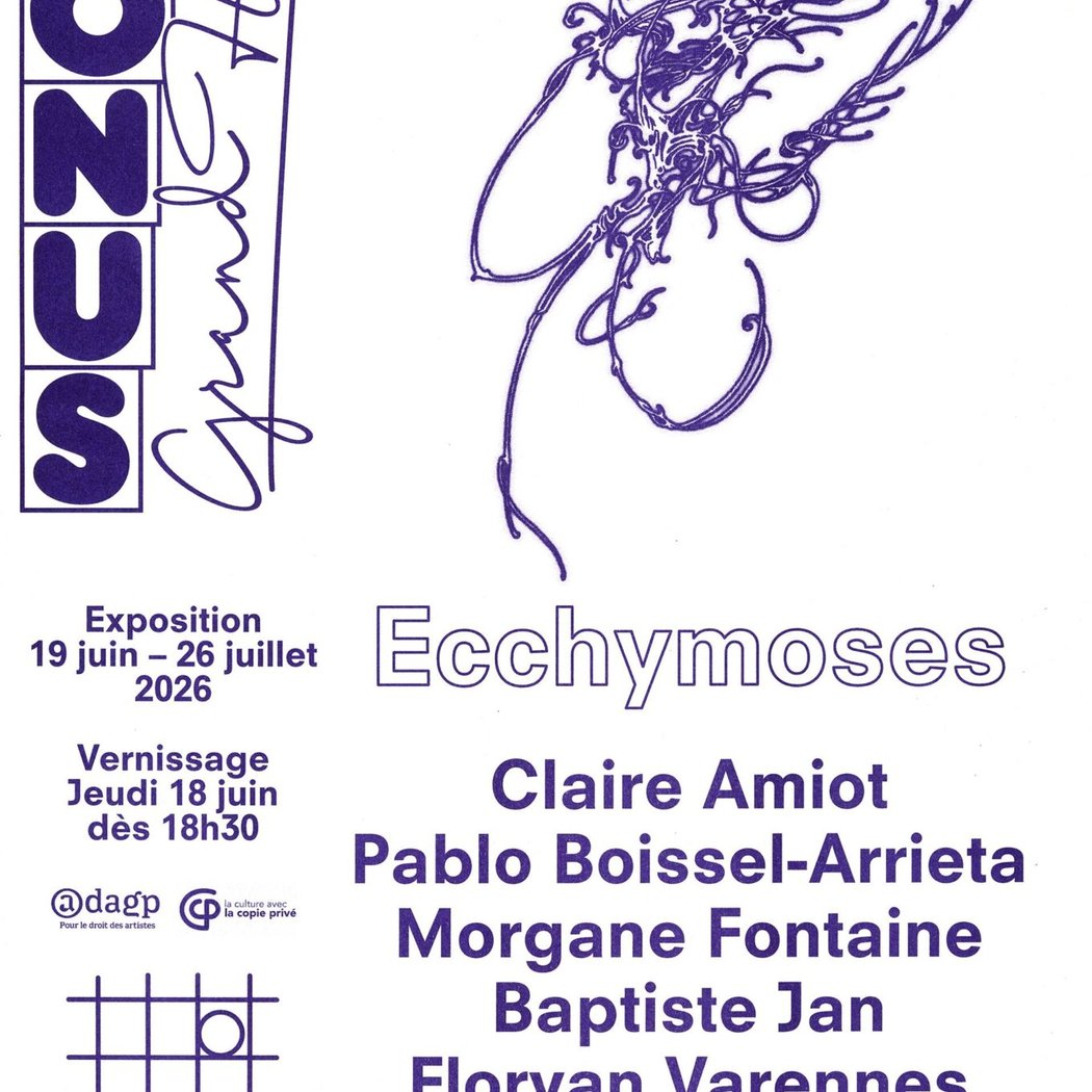Ecchymoses