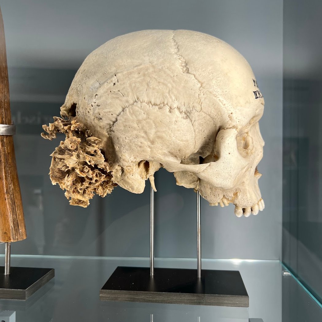 Pathological-anatomical collection in the Narrenturm 3