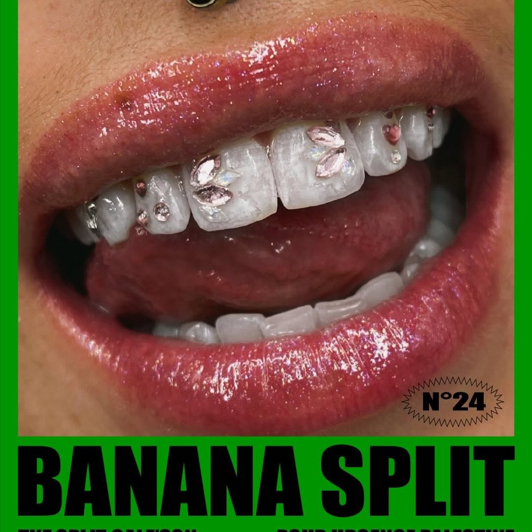 Banana Split 24 : TKZ split Cale’Son pour Urgence Palestine 1