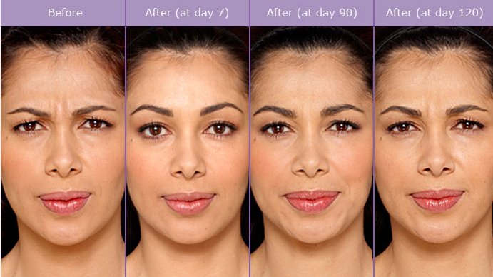 Medspa California 2