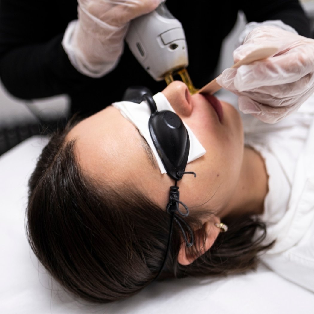 Bared Monkey Laser Spa - Grand Central 1
