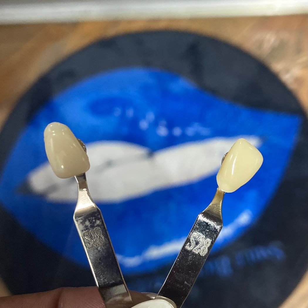 Smile Bigger with Danni:Teeth Whitening & Tooth Gems 3