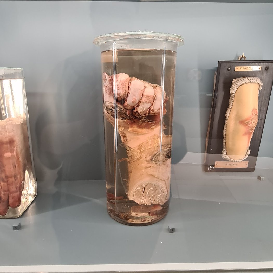 Pathological-anatomical collection in the Narrenturm 2