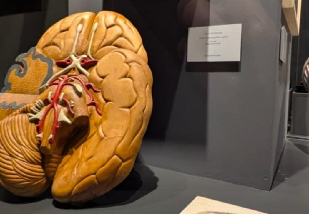 Visita guiada a la exposición Cerebro(s) 1