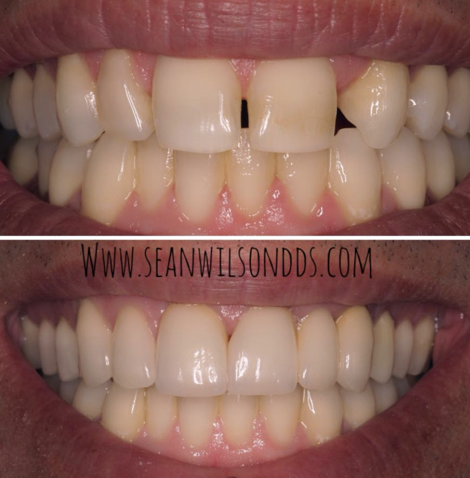 Sean Wilson, DDS – Santa Rosa Dentist 4